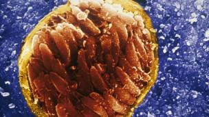 Quiste de toxoplasma