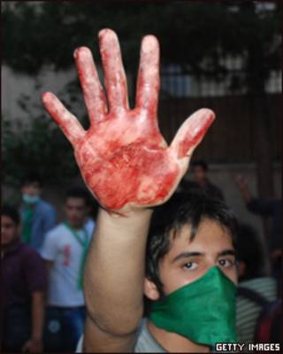 Manifestante mostra mão manchada de sangue durante protesto em Teerã (Getty Images)