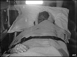 Michael Jackson em uma ambulância logo depois do acidente (arquivo)