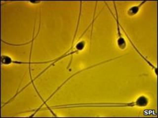 Espermatozoides
