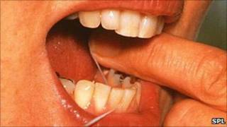 Pessoa usando fio dental (arquivo/SPL)