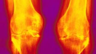 Radiografia
