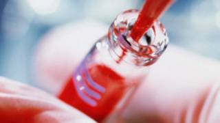 Prueba de sangre