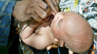 Vaksinasi polio