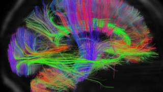 cerebro