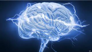 Cerebro