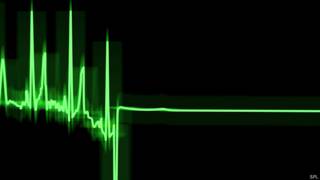 Monitor de corazón