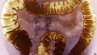 Rayos X de intestinos