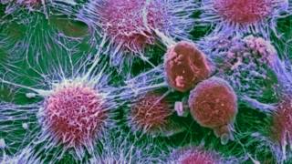 Cáncer