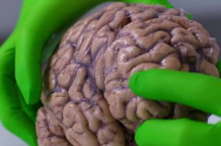 cerebro humano