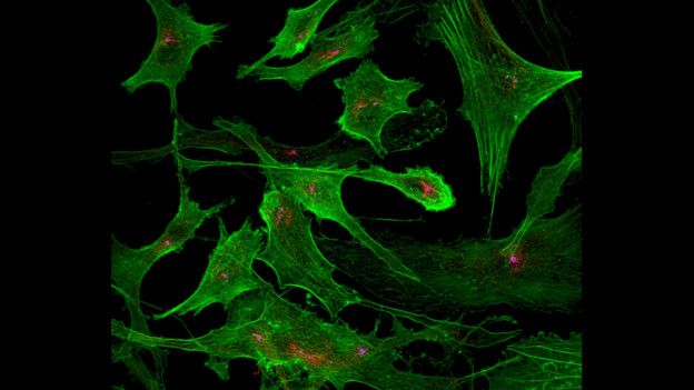 Oenocitos humanos teñidos por actina (verde), tubulina acetilada (rojo) y cuerpo basal (magenta). Dan Rowson.