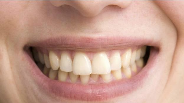 Una sonrisa