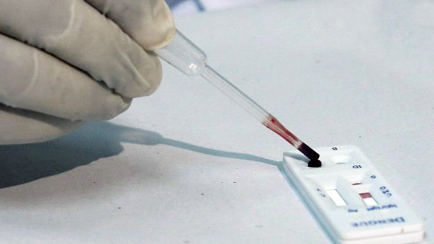 Un trabajador de salud en Brasil usa el nuevo kit que diagnostica tres virus causados por mosquitos, incluida el zika.