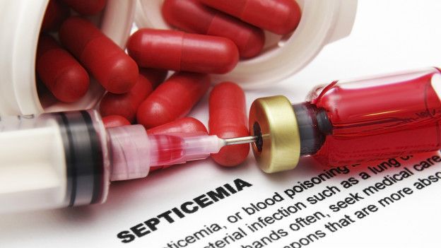 Septicemia