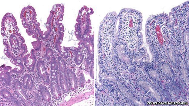 Intestino delgado.