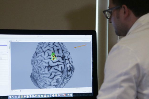 Un médico observa un cerebro en una computadora