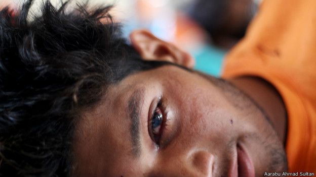 Eye damage from shrapnel in Kashmir