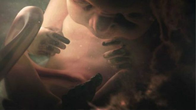 Más de la mitad de las muertes fetales intrauterinas son evitables.